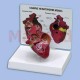 Model - psí srdce střední velikosti infikované srdeční červivostí - průřez