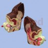 2-sided average size canine ear despicts abnormal side illustrates inflamed inner ear structures, inflammatory exudates in